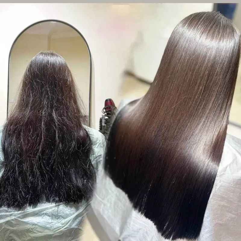 بوتاکس و‌پروتئین تراپی همزمان